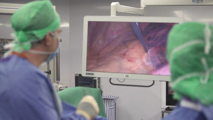 Le diagnostic précoce, facteur déterminant dans la lutte contre le cancer du poumon (congrès)